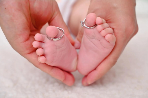 定安怀孕妊娠线不明显